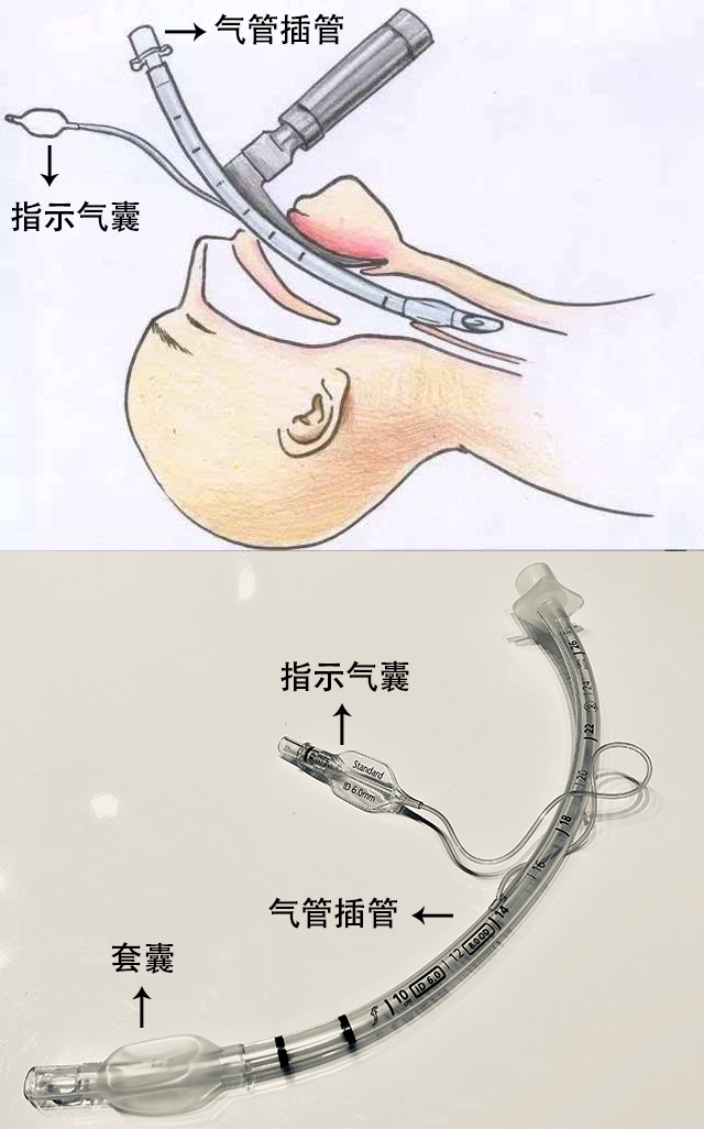 贊?。?！250萬指示氣囊，客戶100%滿意！